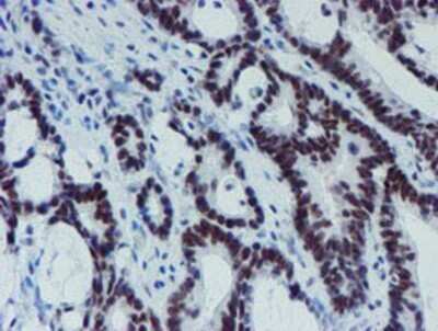 Immunohistochemistry: METT10D Antibody (OTI3B5) - Azide and BSA Free [NBP2-72654]