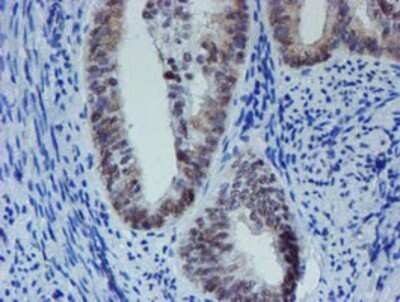 Immunohistochemistry: METT10D Antibody (OTI3B5) - Azide and BSA Free [NBP2-72654]