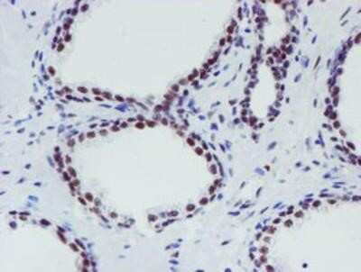 Immunohistochemistry-Paraffin: METT10D Antibody (OTI3B5) [NBP2-02026]