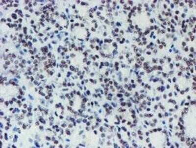 Immunohistochemistry-Paraffin: METT10D Antibody (OTI3B5) [NBP2-02026]