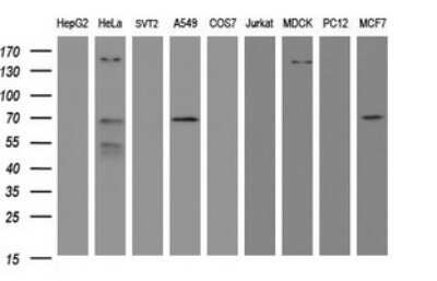 Western Blot: METT10D Antibody (OTI3E8)Azide and BSA Free [NBP2-72653]