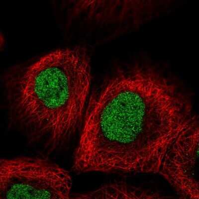 Immunocytochemistry/ Immunofluorescence: METTL1 Antibody [NBP2-58787]