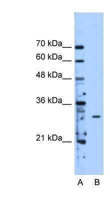 Western Blot: METTL1 Antibody [NBP1-54928]