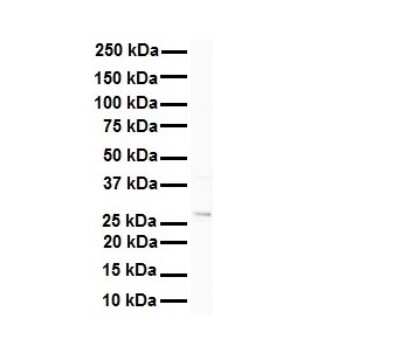 Western Blot: METTL11B Antibody [NBP1-70635]