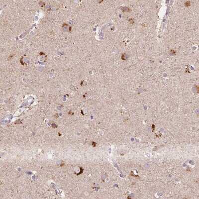 Immunohistochemistry-Paraffin: METTL13 Antibody [NBP2-38709]
