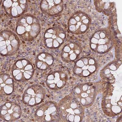 Immunohistochemistry-Paraffin: METTL13 Antibody [NBP1-92109]