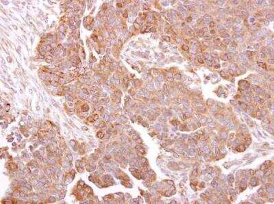 Immunohistochemistry-Paraffin: METTL13 Antibody [NBP2-17281]