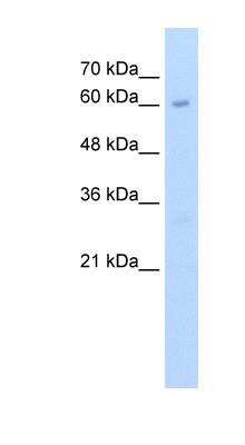 Western Blot: METTL13 Antibody [NBP1-55484]