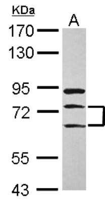 Western Blot: METTL13 Antibody [NBP2-17281]