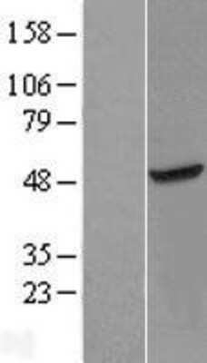 Western Blot: METTL18 Overexpression Lysate [NBL1-08300]