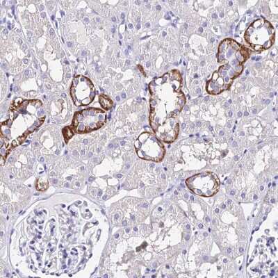 Immunohistochemistry-Paraffin: METTL19 Antibody [NBP1-92110]