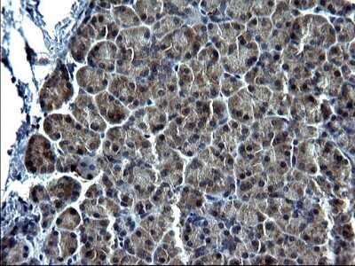 Immunohistochemistry: METTL25 Antibody (OTI2B6) [NBP2-46590]