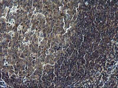 Immunohistochemistry: METTL25 Antibody (OTI2B6) [NBP2-46590]