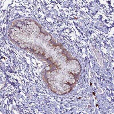 Immunohistochemistry-Paraffin: METTL25 Antibody [NBP1-82105]