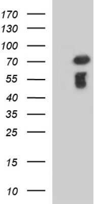 Western Blot: METTL25 Antibody (OTI2B6)Azide and BSA Free [NBP2-72656]