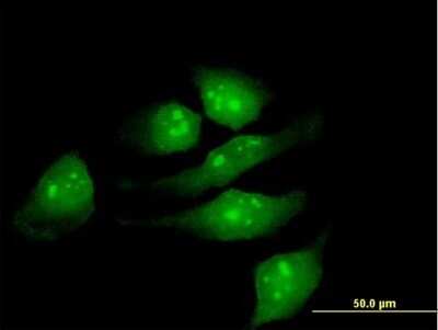 Immunocytochemistry/ Immunofluorescence: METTL2B Antibody [H00055798-B01P]