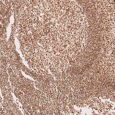Immunohistochemistry-Paraffin: METTL4 Antibody [NBP1-82095]