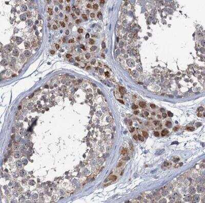 Immunohistochemistry-Paraffin: METTL4 Antibody [NBP1-82095]
