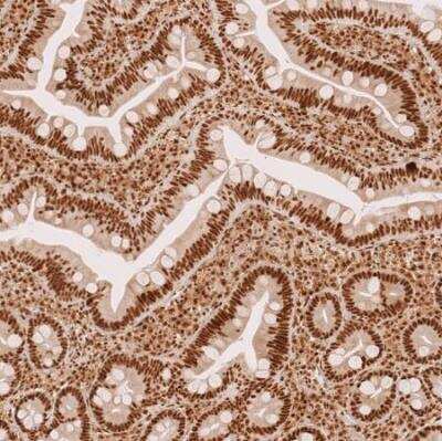 Immunohistochemistry-Paraffin: METTL4 Antibody [NBP1-82095]