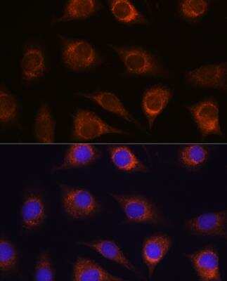 Immunocytochemistry/ Immunofluorescence: METTL7A Antibody - BSA Free [NBP3-04948]