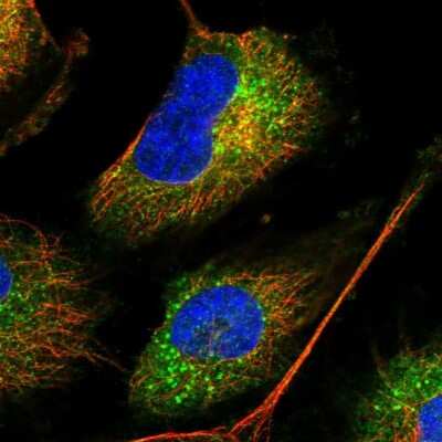 Immunocytochemistry/ Immunofluorescence: METTL7B Antibody [NBP2-47377]