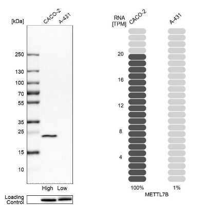 Western Blot: METTL7B Antibody [NBP2-47377]
