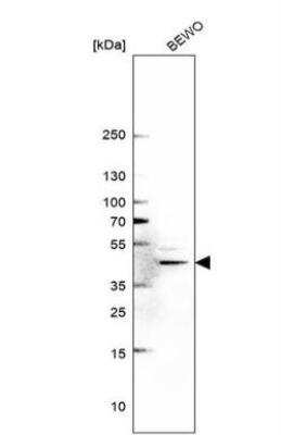 Western Blot: METTL8 Antibody [NBP1-94012]