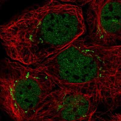 Immunocytochemistry/ Immunofluorescence: MFAP3 Antibody [NBP2-55417]
