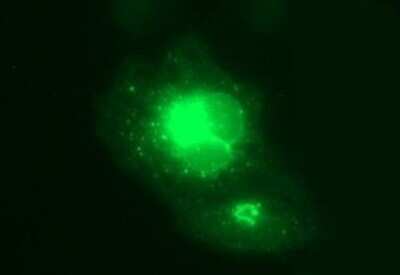 Immunocytochemistry/ Immunofluorescence: MFAP3 Antibody (OTI1B3) - Azide and BSA Free [NBP2-72657]