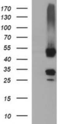 Western Blot: MFAP3 Antibody (OTI1B3) [NBP2-45824]