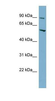 Western Blot: MFSD1 Antibody [NBP1-59624]