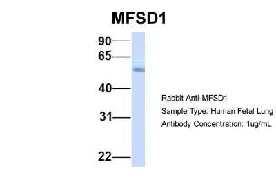 Western Blot: MFSD1 Antibody [NBP1-59624]