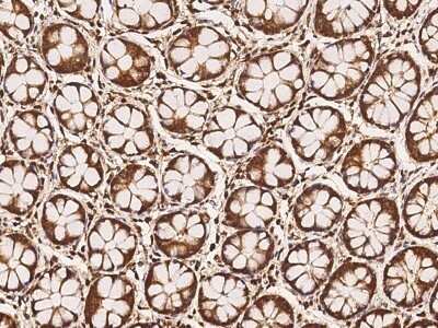 Immunohistochemistry-Paraffin: MFSD11 Antibody [NBP3-06336]