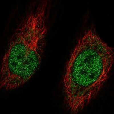 Immunocytochemistry/ Immunofluorescence: MGA Antibody [NBP2-55033]