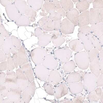 Immunohistochemistry-Paraffin: MGA Antibody [NBP1-94031]