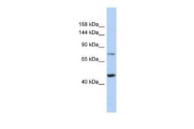Western Blot: MGA Antibody [NBP2-85277]