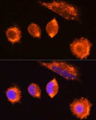 Immunocytochemistry/ Immunofluorescence: MGAT1 Antibody - BSA Free [NBP3-04742]