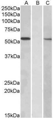 Western Blot: MGAT1 Antibody [NBP1-52077]