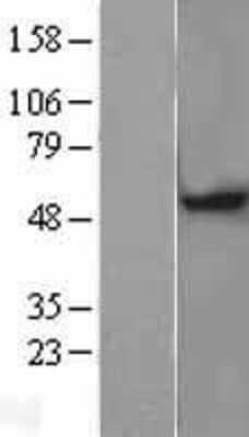Western Blot: MGAT1 Overexpression Lysate [NBP2-09399]