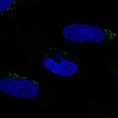 Immunocytochemistry/ Immunofluorescence: MGAT2 Antibody [NBP2-58625]