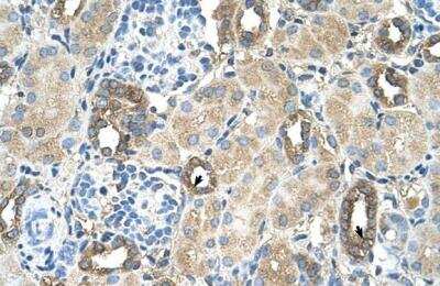 Immunohistochemistry-Paraffin: MGAT2 Antibody [NBP1-69335]