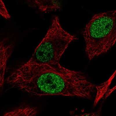 Immunocytochemistry/ Immunofluorescence: MGAT5B Antibody [NBP2-58992]