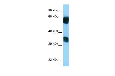 Western Blot: MGAT5B Antibody [NBP2-83202]