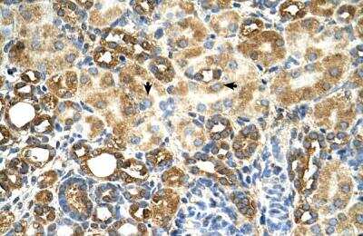 Immunohistochemistry-Paraffin: MGC16471 Antibody [NBP1-79269]