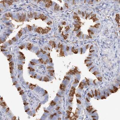 Immunohistochemistry-Paraffin: MGC16471 Antibody [NBP1-88005]