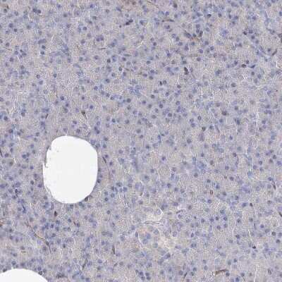 Immunohistochemistry-Paraffin: MGC16471 Antibody [NBP1-88005]