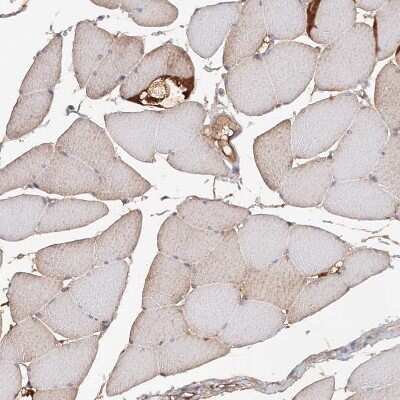 Immunohistochemistry-Paraffin: MGC16471 Antibody [NBP1-88005]