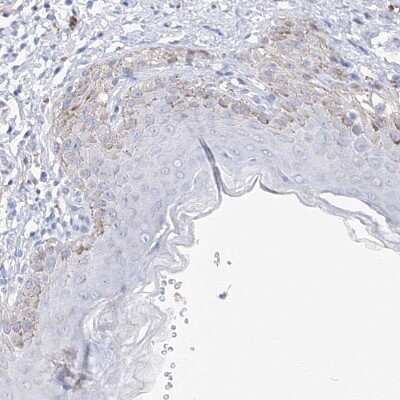 Immunohistochemistry-Paraffin: MGC16471 Antibody [NBP1-88005]