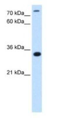 Western Blot: MGC16471 Antibody [NBP1-79269]