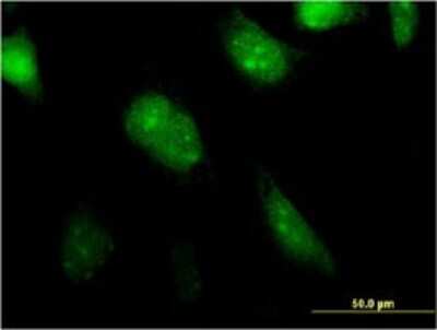 Immunocytochemistry/ Immunofluorescence: MGC20410 Antibody (1B11) [H00116071-M01]